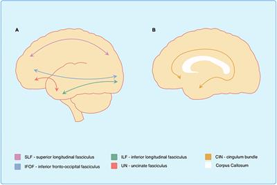 Structural Connectivity in Down Syndrome and Alzheimer’s Disease